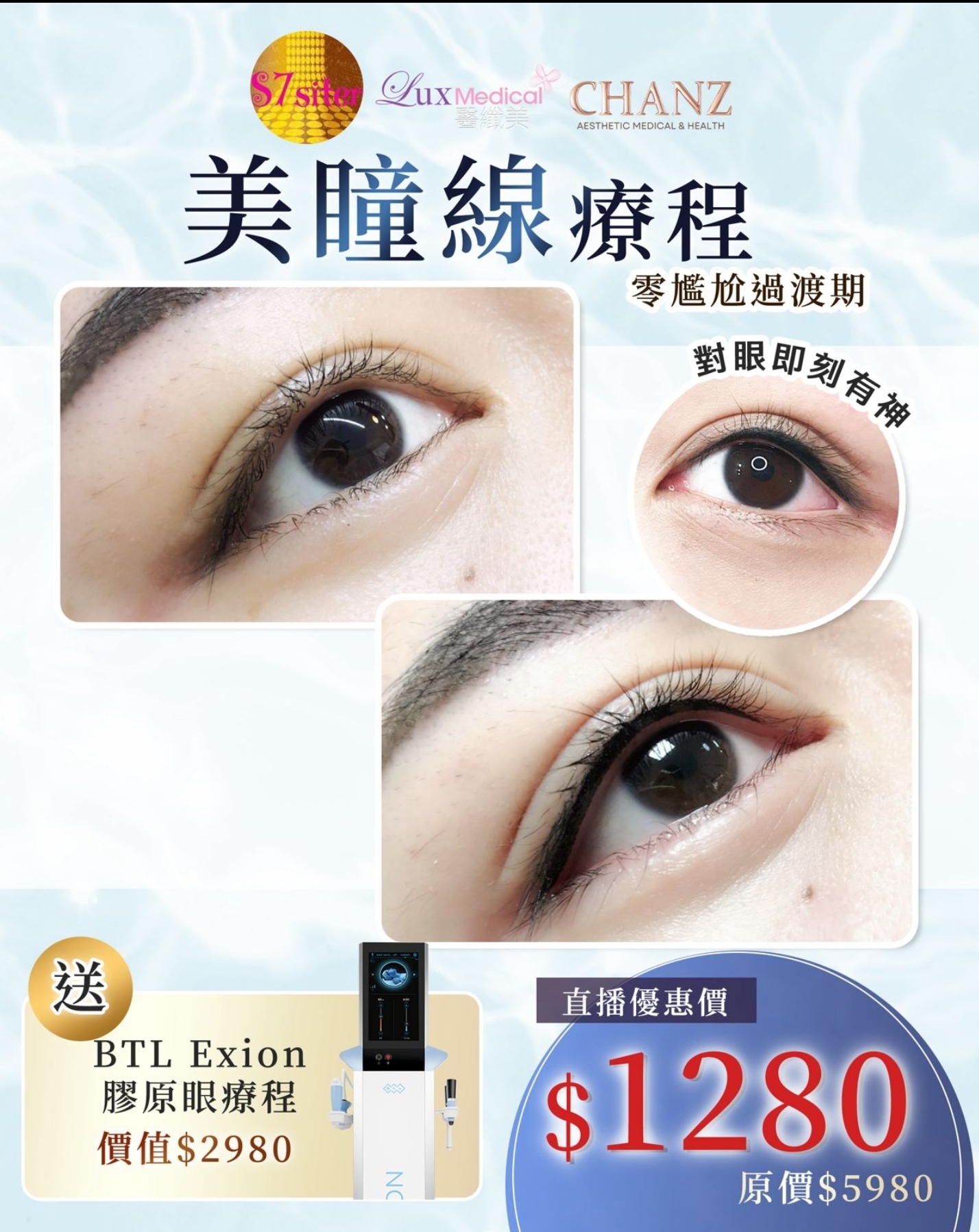Cd8811   半永久項目：美瞳線療程  送 BTL Exion 膠原眼療程 價值$2980