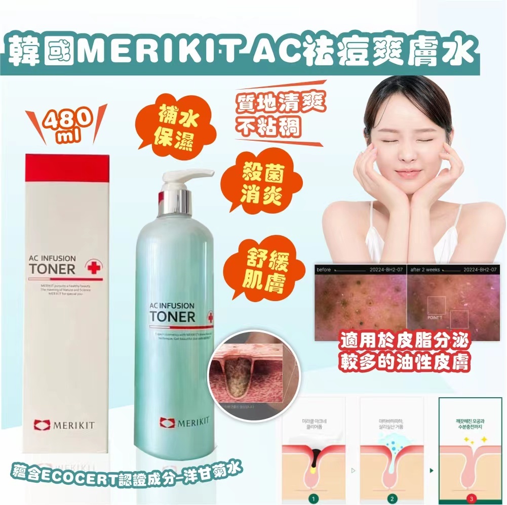 韓國 MERIKIT AC 祛痘爽膚水
