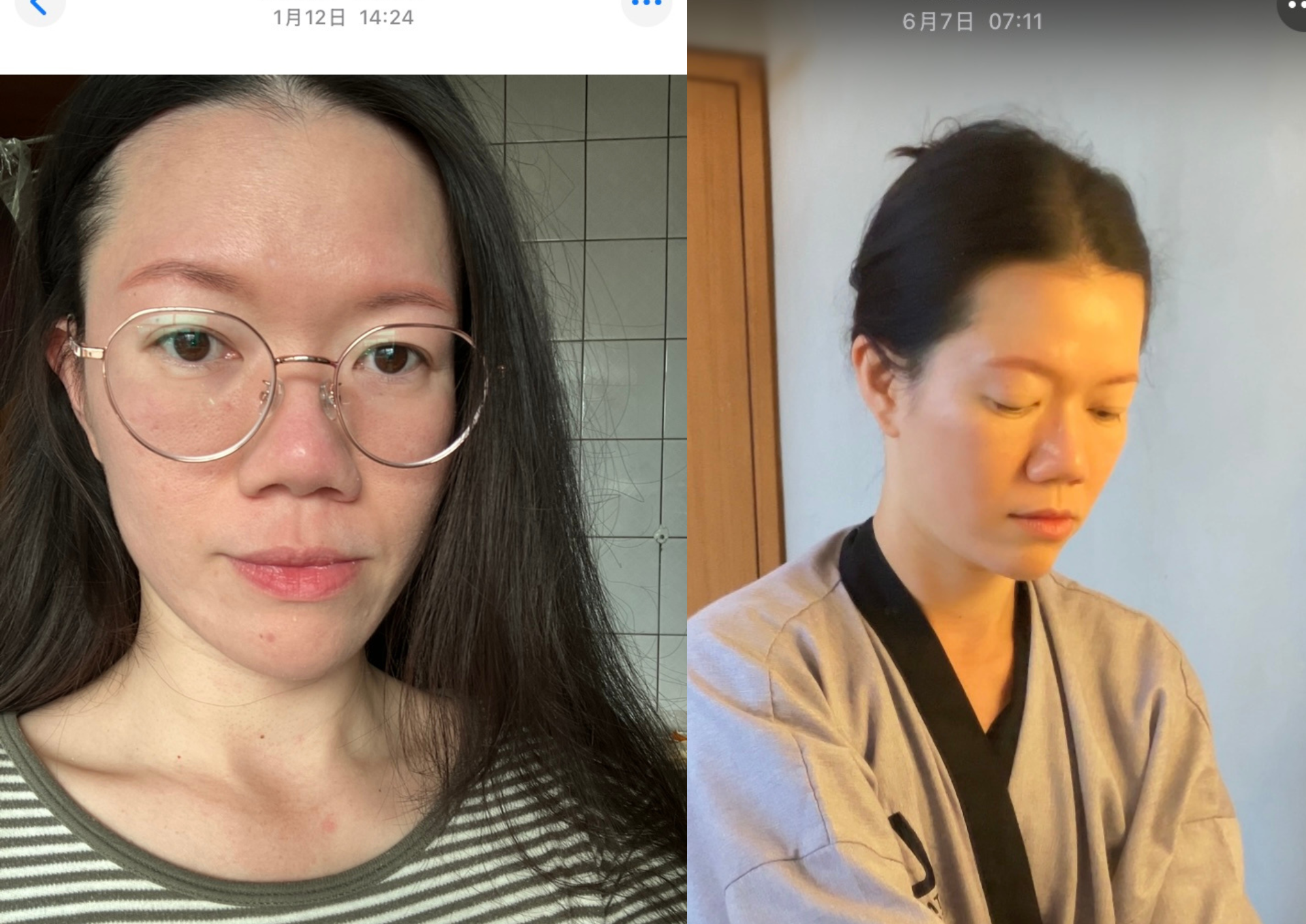 純肥皂, 肌斷食, 手工皂, the soap days, 純皂生活, 極簡保養, 臉部出油, 粉刺調理