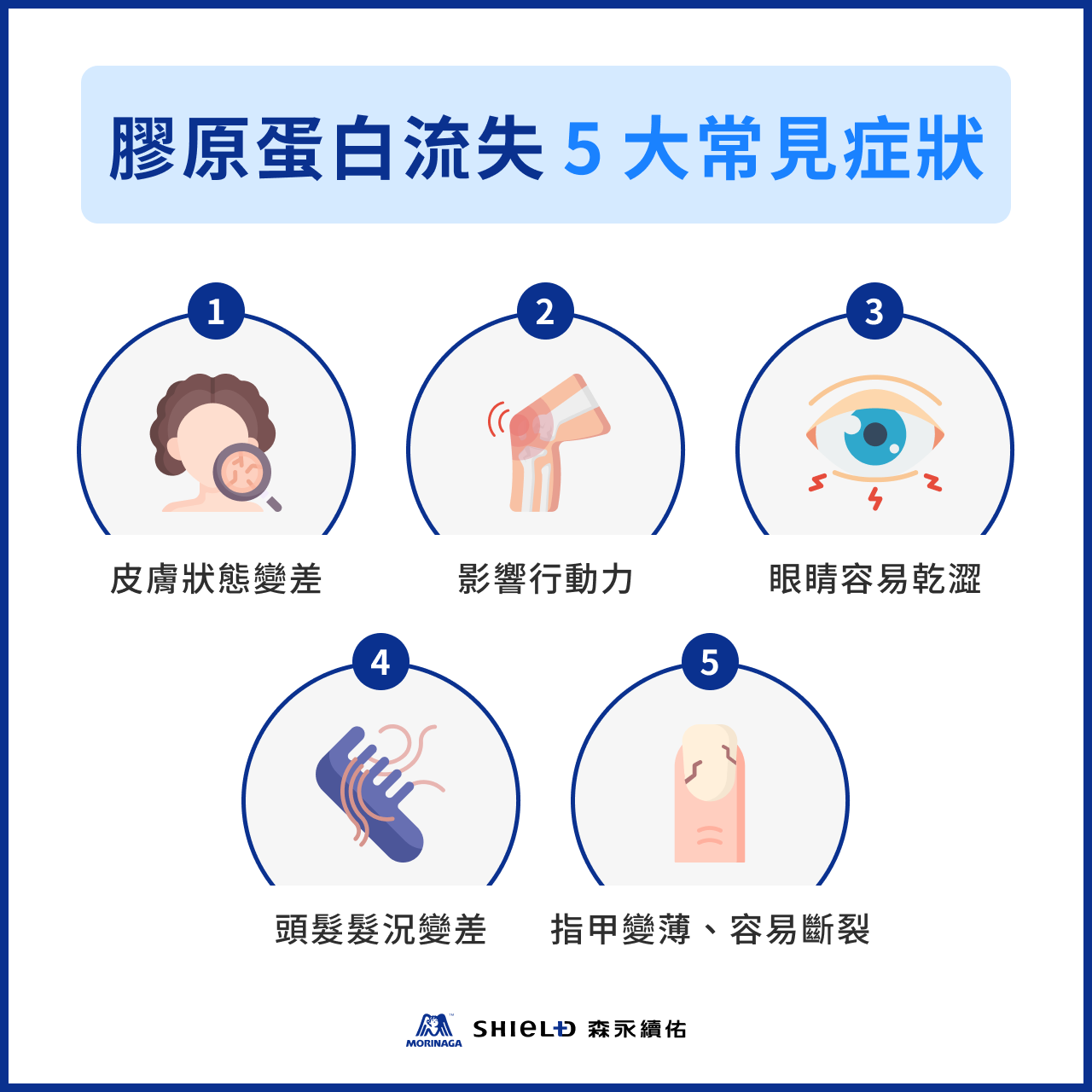 膠原蛋白流失 5 大常見症狀