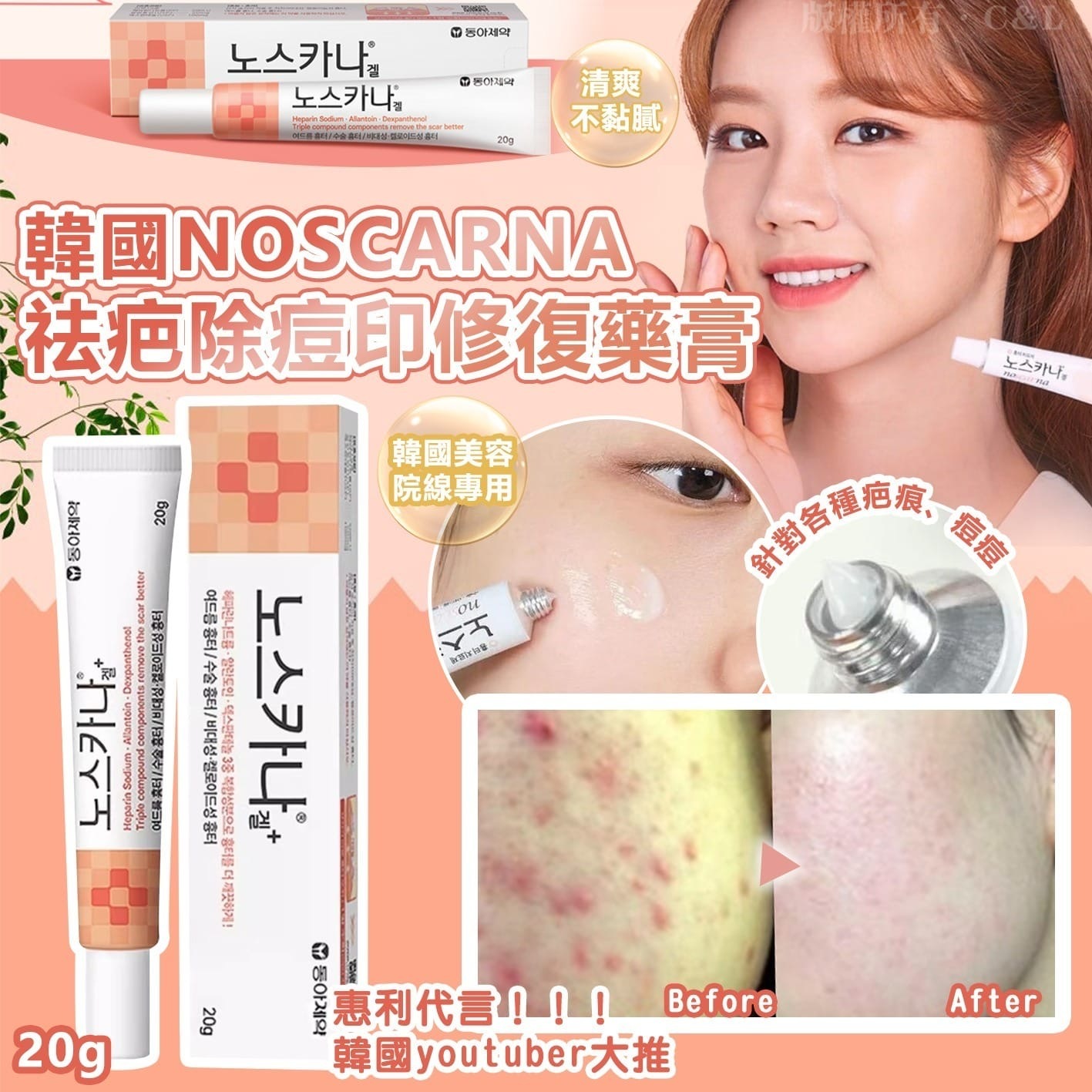 韓國NOSCARNA祛疤除痘印修復藥膏20g