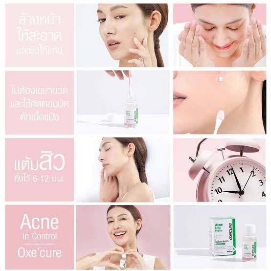 泰國🇹🇭 OXECURE Acne Clear Potion 粉刺痘痘神水 (15ml）（T6 T658)）