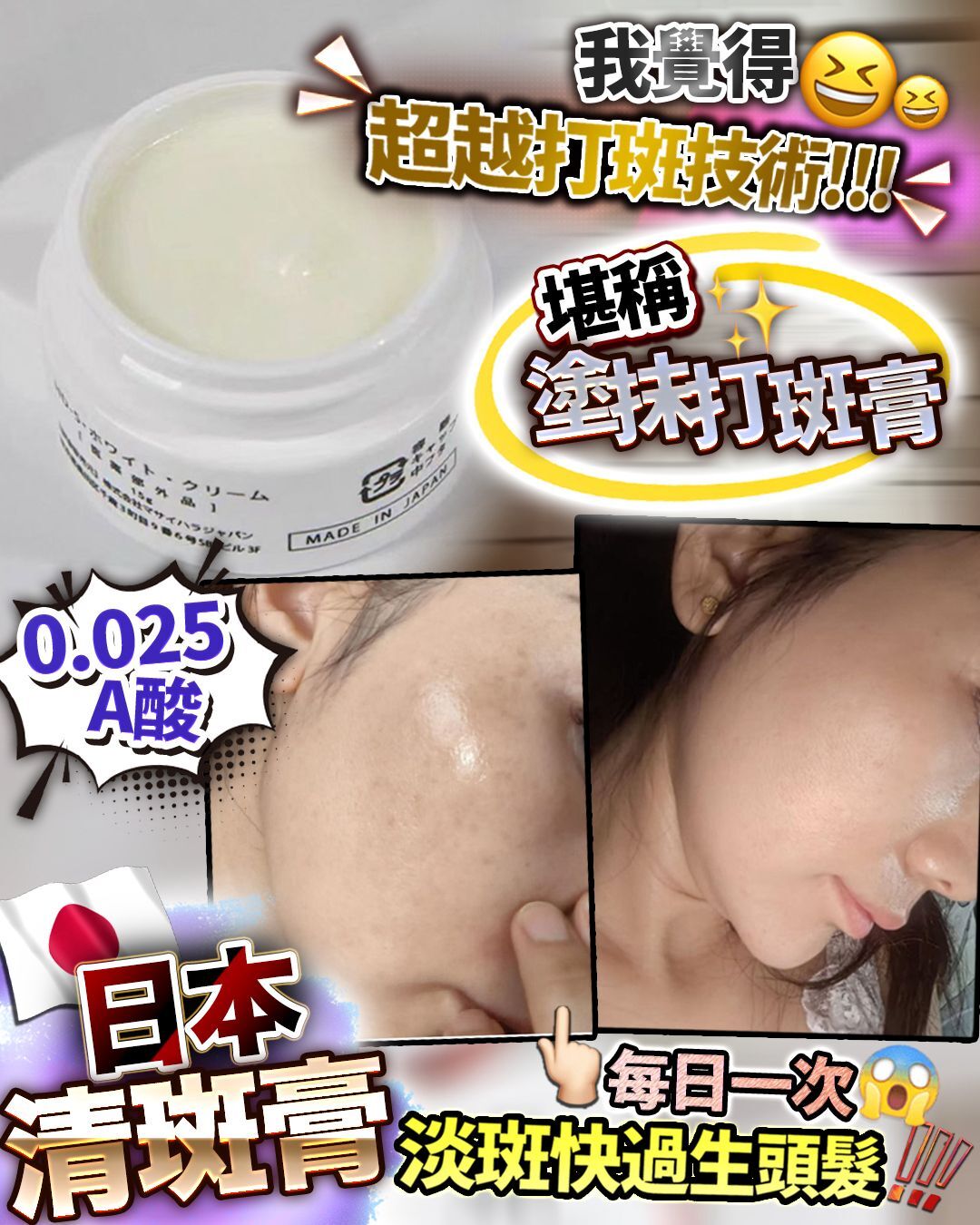 💥清斑膏 15g 重點塗抹