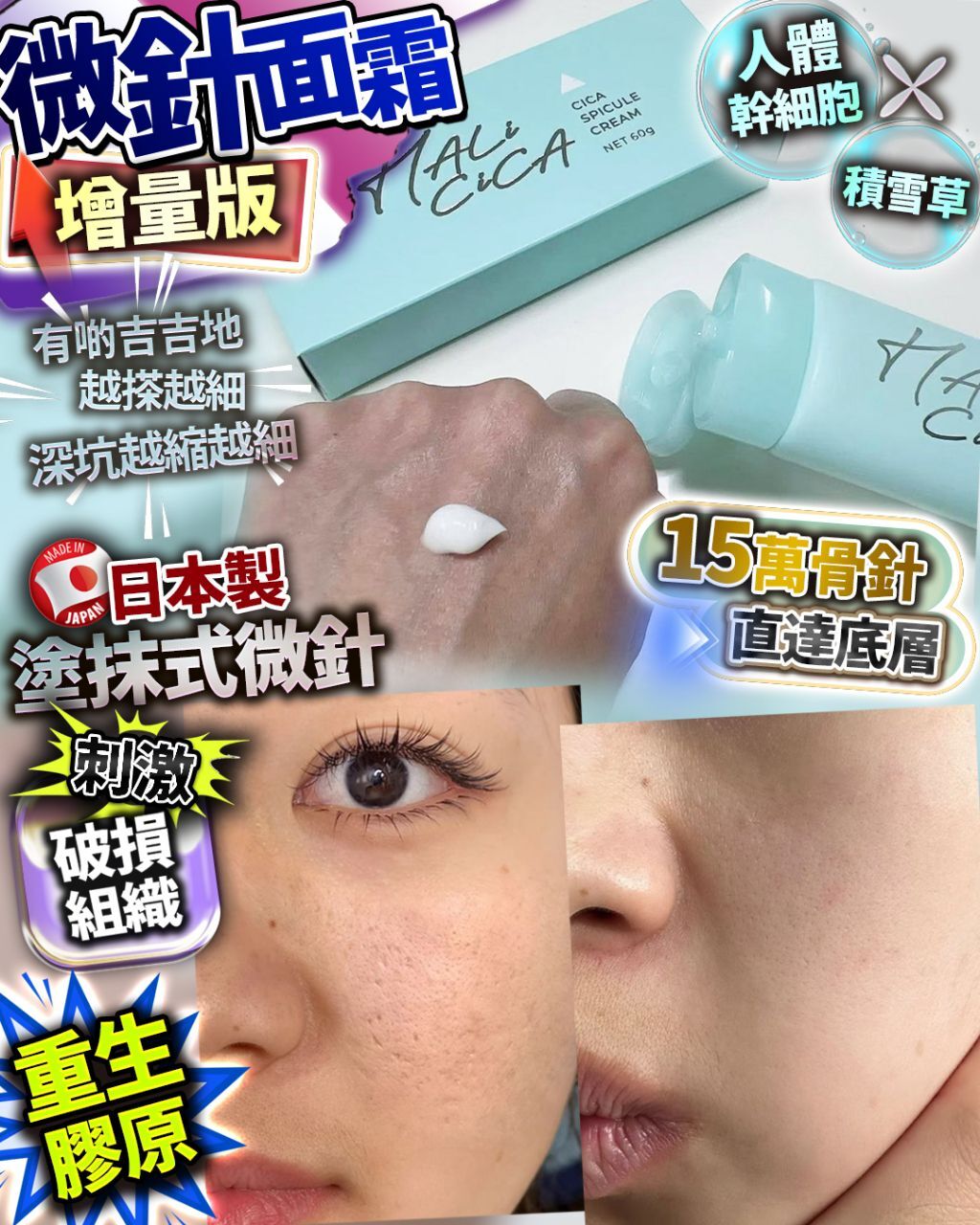 💥日本海藻微針面霜 60g