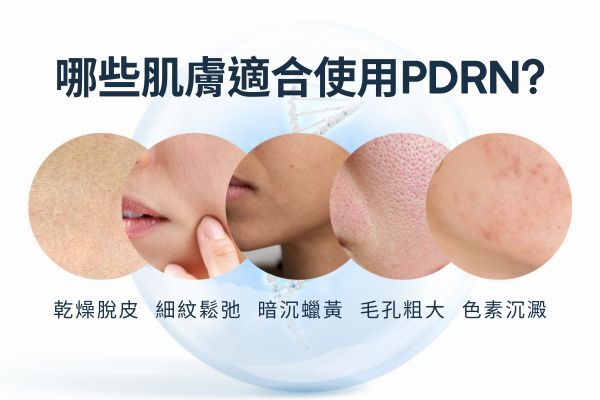 PDRN適合的肌膚