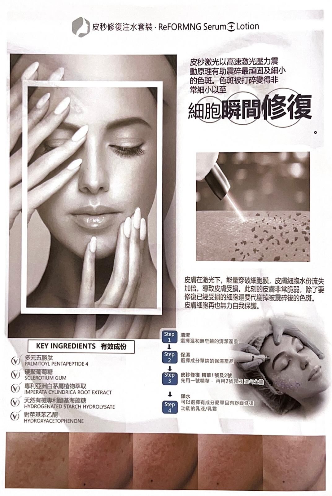 ⑥ CUTHYS 皮秒修復注水套裝 (一套2支)