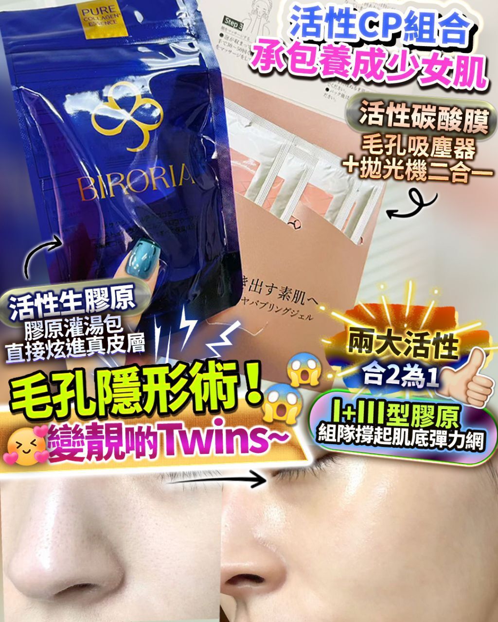 重生碳酸+嬰兒膠原