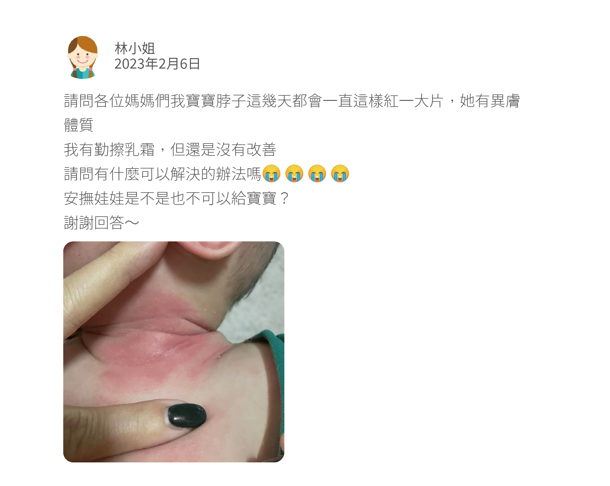 請問各位媽媽們我寶寶脖子這幾天都會一直這樣紅一大片，她有異膚體質 我有勤擦乳霜，但還是沒有改善 請問有什麼可以解決的辦法嗎 安撫娃娃是不是也不可以給寶寶？ 謝謝回答～