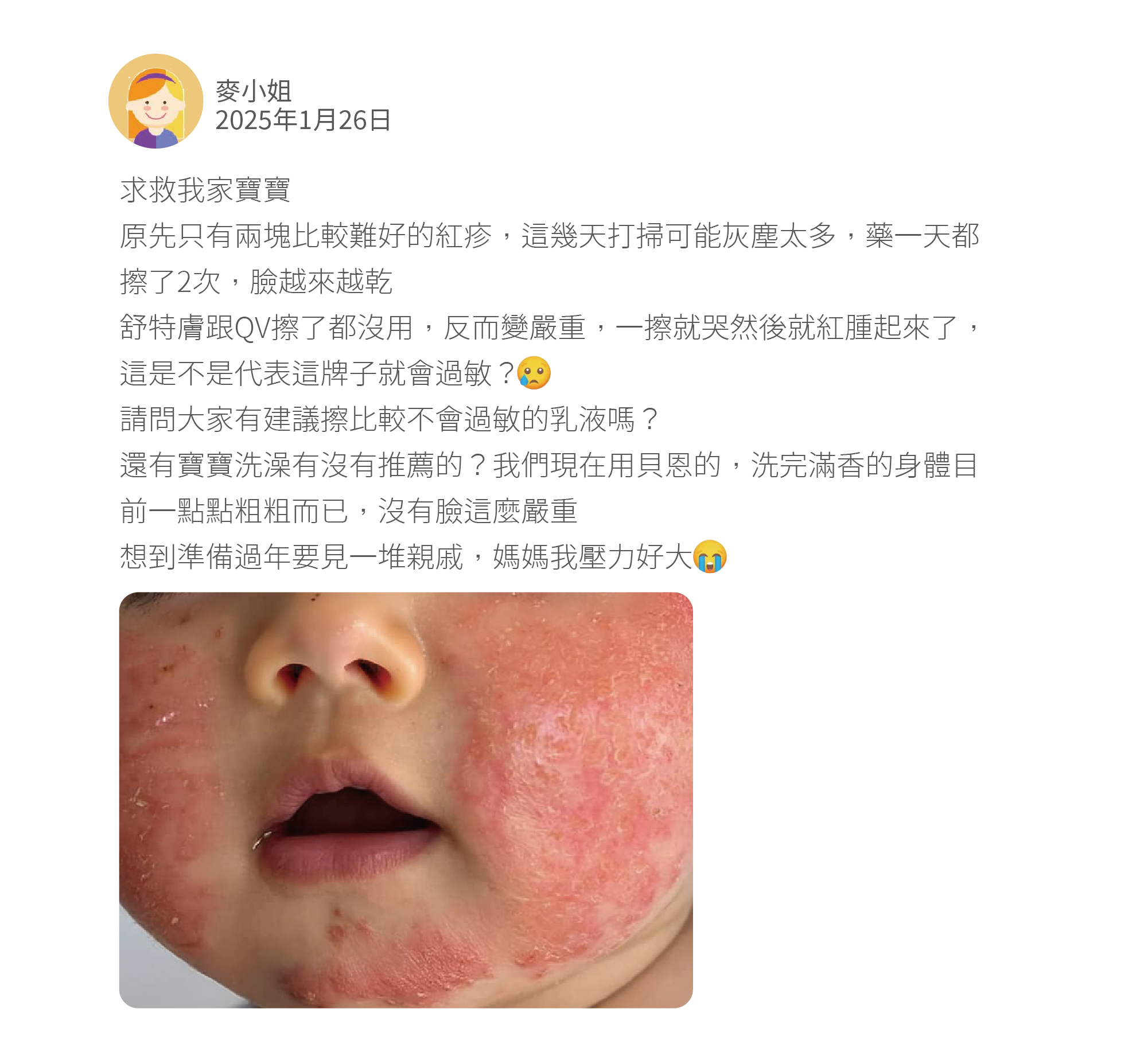 求救我家寶寶 原先只有兩塊比較難好的紅疹，這幾天打掃可能灰塵太多，藥一天都擦了2次，臉越來越乾 舒特膚跟QV擦了都沒用，反而變嚴重，一擦就哭然後就紅腫起來了，這是不是代表這牌子就會過敏？ 請問大家有建議擦比較不會過敏的乳液嗎？ 還有寶寶洗澡有沒有推薦的？我們現在用貝恩的，洗完滿香的身體目前一點點粗粗而已，沒有臉這麼嚴重 想到準備過年要見一堆親戚，媽媽我壓力好大