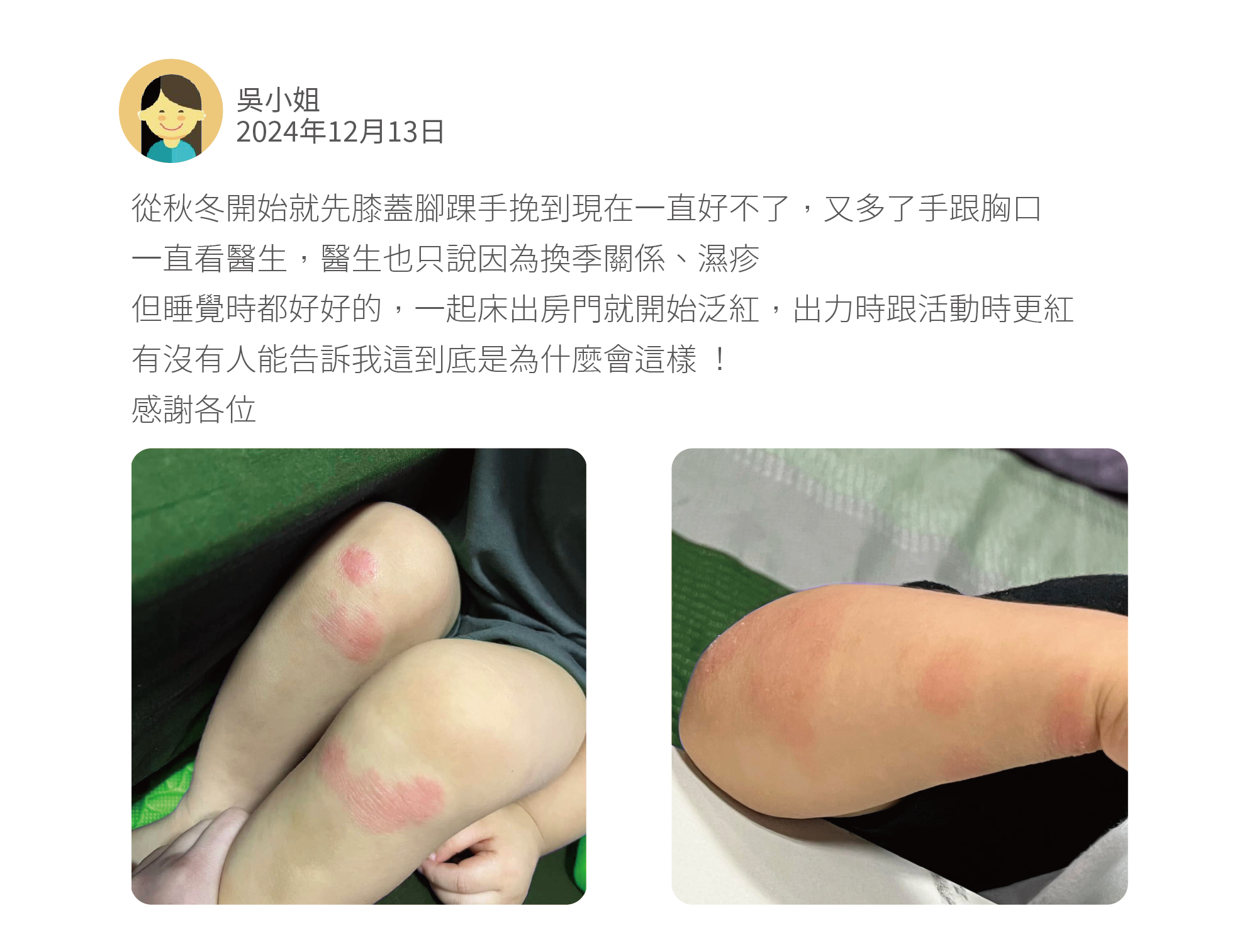 從秋冬開始就先膝蓋腳踝手挽到現在一直好不了，又多了手跟胸口 一直看醫生，醫生也只說因為換季關係、濕疹 但睡覺時都好好的，一起床出房門就開始泛紅，出力時跟活動時更紅 有沒有人能告訴我這到底是為什麼會這樣 ！ 感謝各位