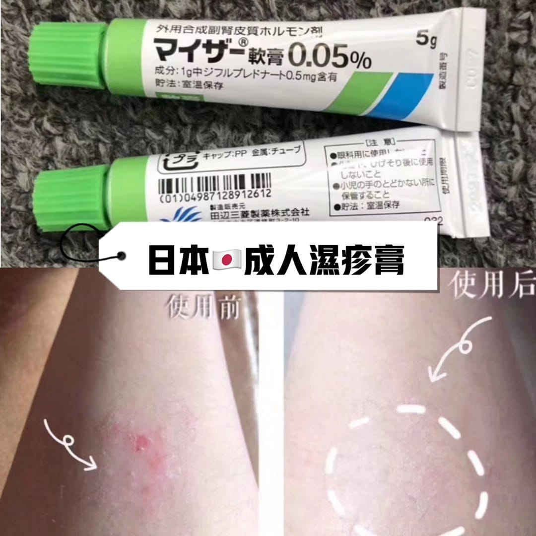 代 購 貨 品 日 本 直 送丨田邊三菱製藥 成人濕疹小綠膏