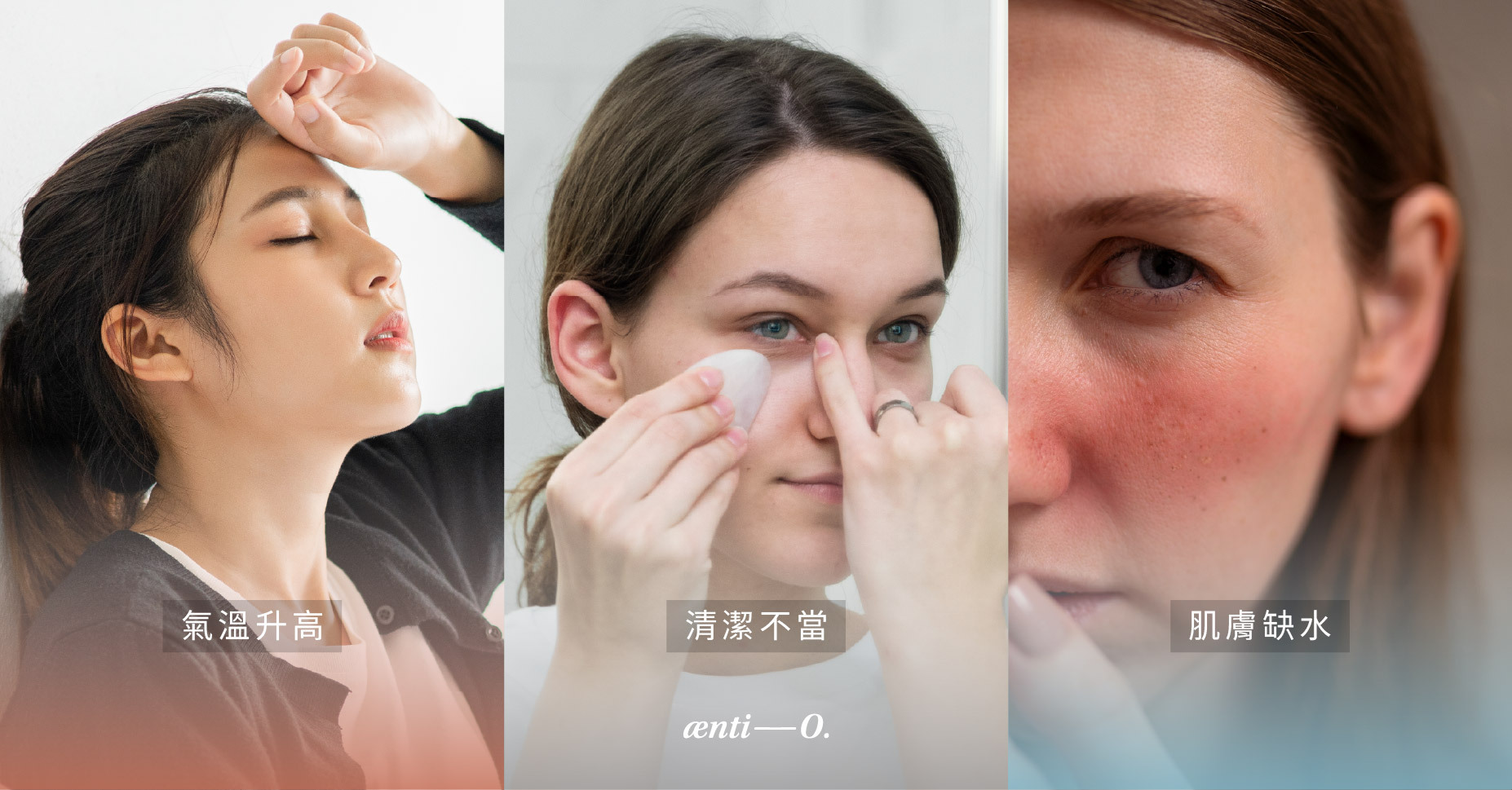 清潔不當、氣溫升高、肌膚缺水都會使毛孔變得粗大明顯