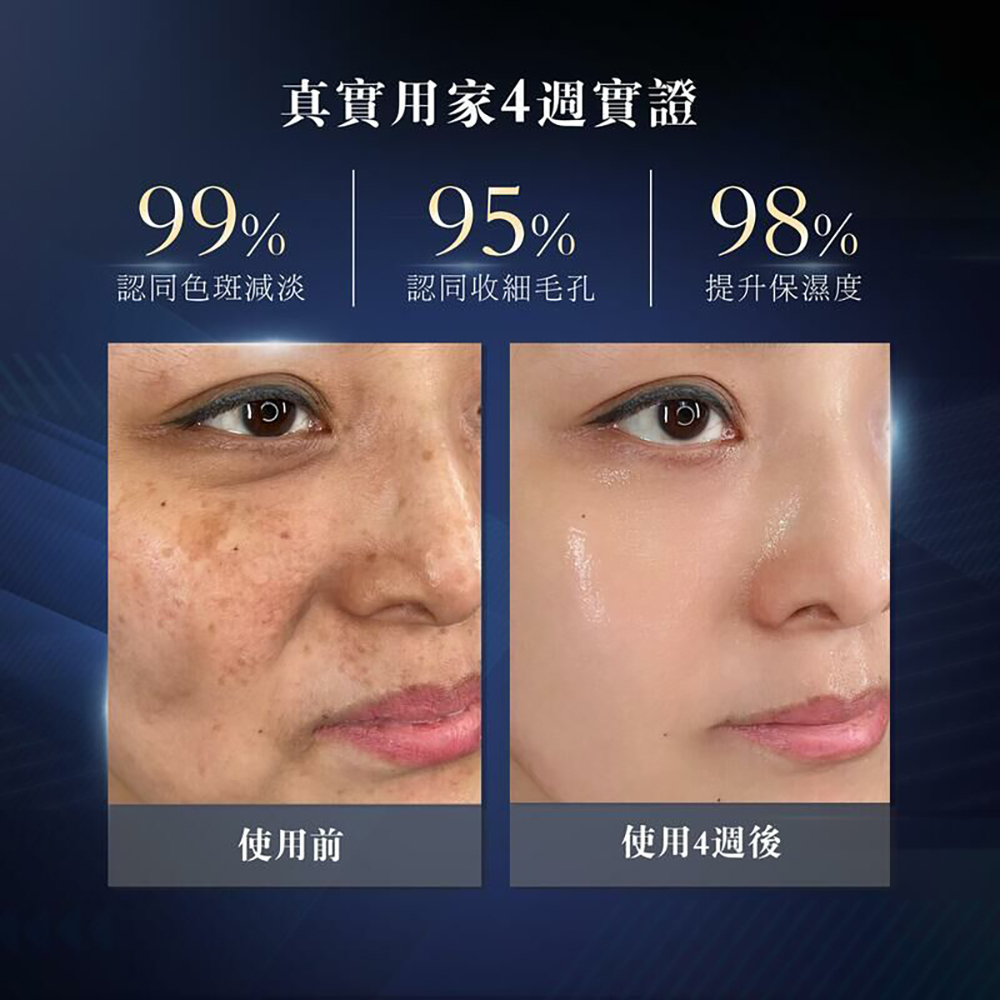 Sliswiss 黑炭皮秒Pico Gel 面膜150ml