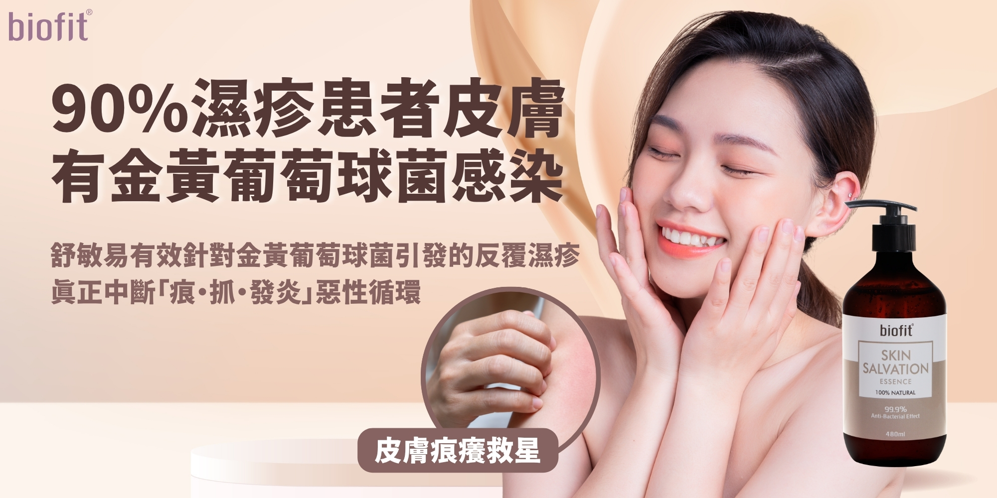 90%濕疹患者皮膚 有金黃葡萄球菌感染