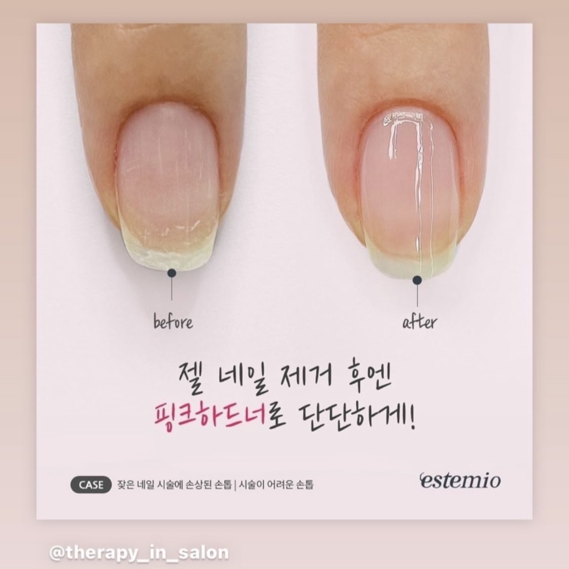 66折 王牌護甲 <素顏粉養甲組合>