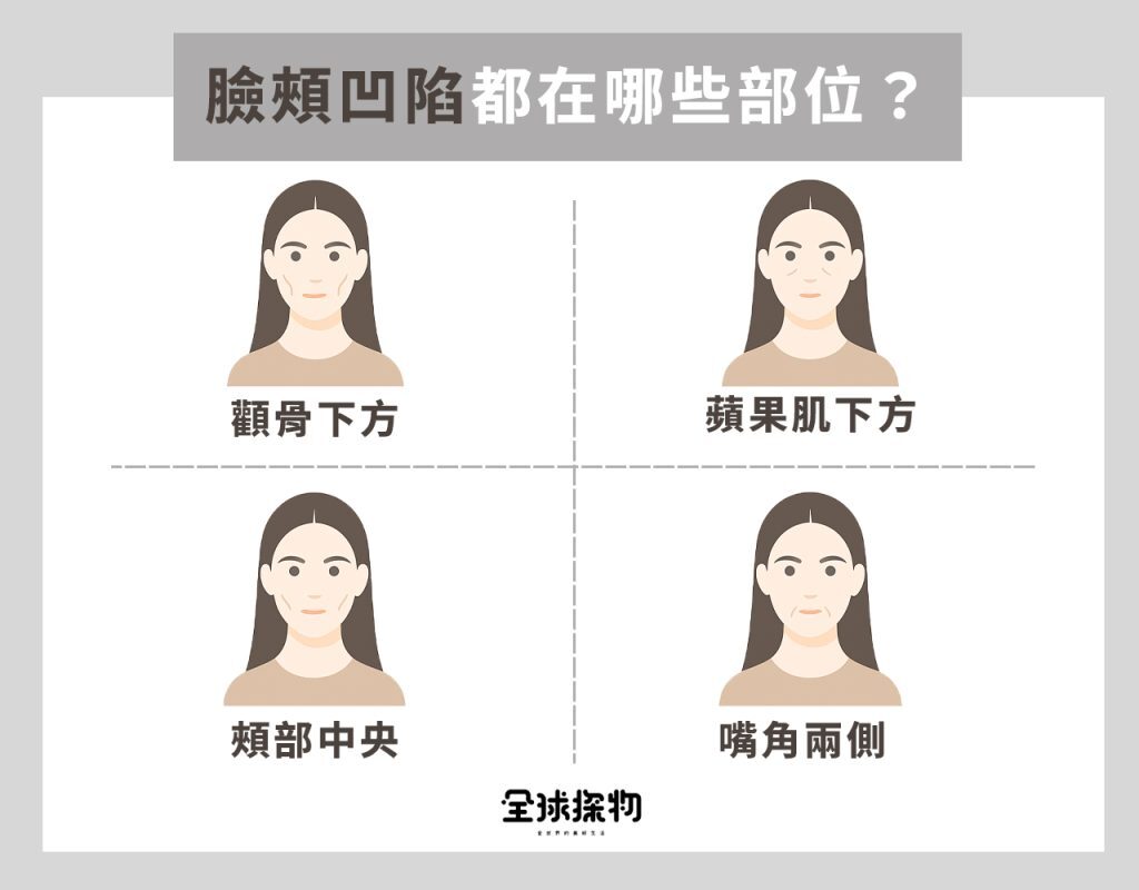 臉頰凹陷都在哪些部位