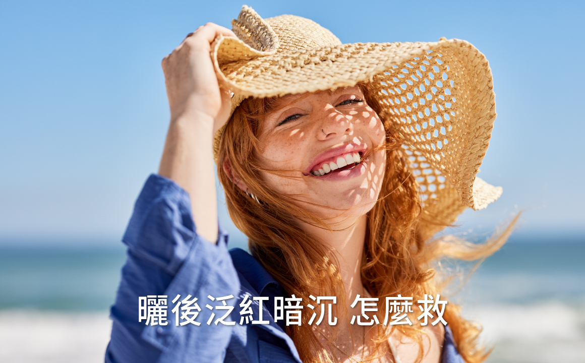 夏日海邊陽光曝曬，女性撐帽微笑，呼應曬後肌膚泛紅暗沉與老化警訊主題。