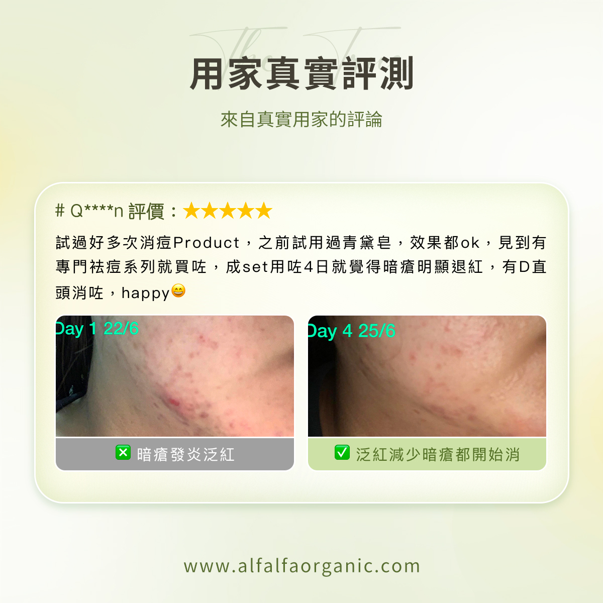 銀花天竺葵消痘化妝水