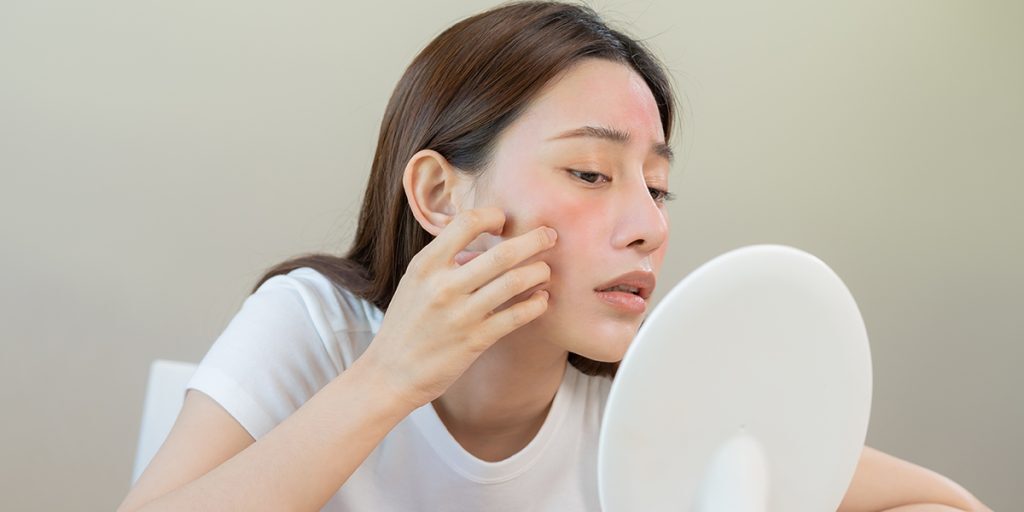 為什麼T字部位出油特別嚴重？