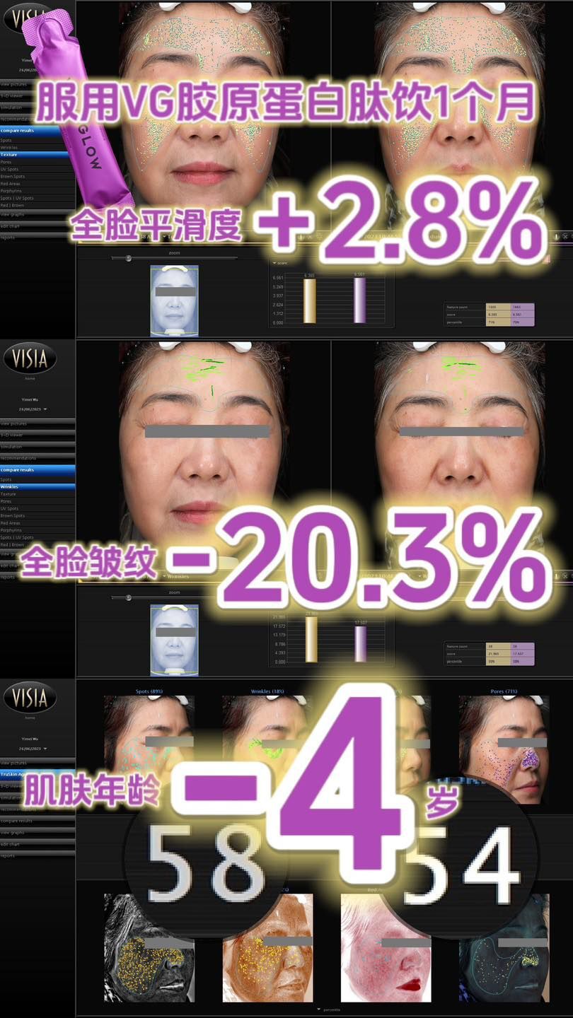 澳洲 Vida Glow VG 膠原蛋白肽飲口服液升級版