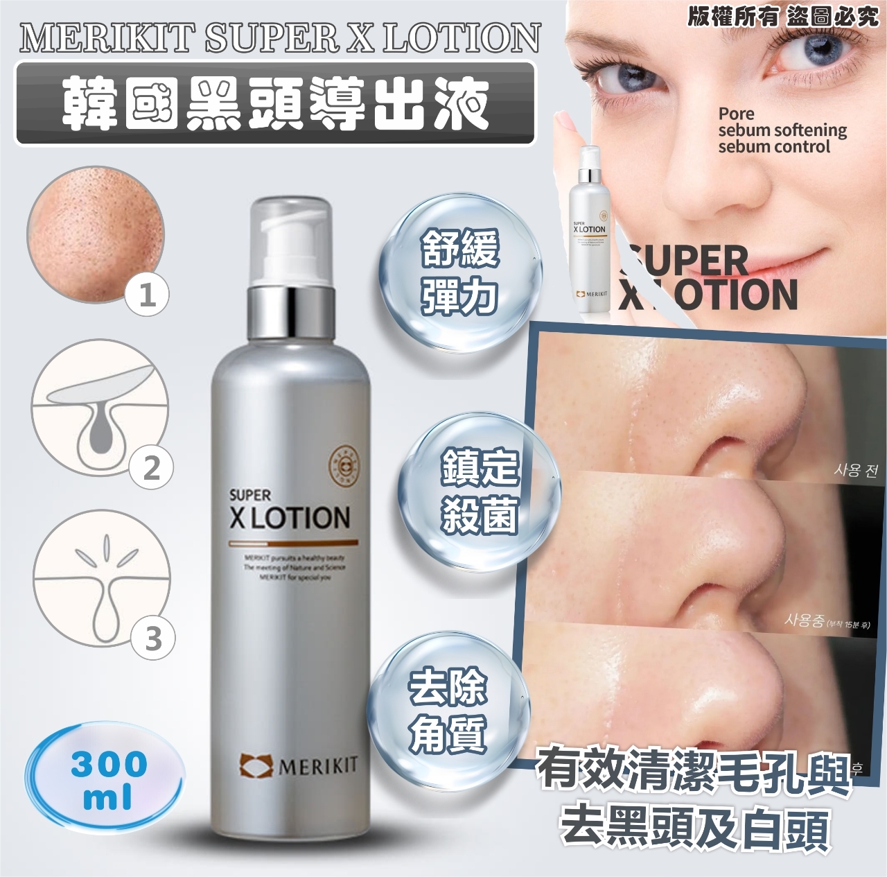 韓國 MERIKIT SUPER X LOTION 黑頭導出液