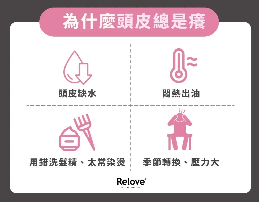 為甚麼頭皮總是癢