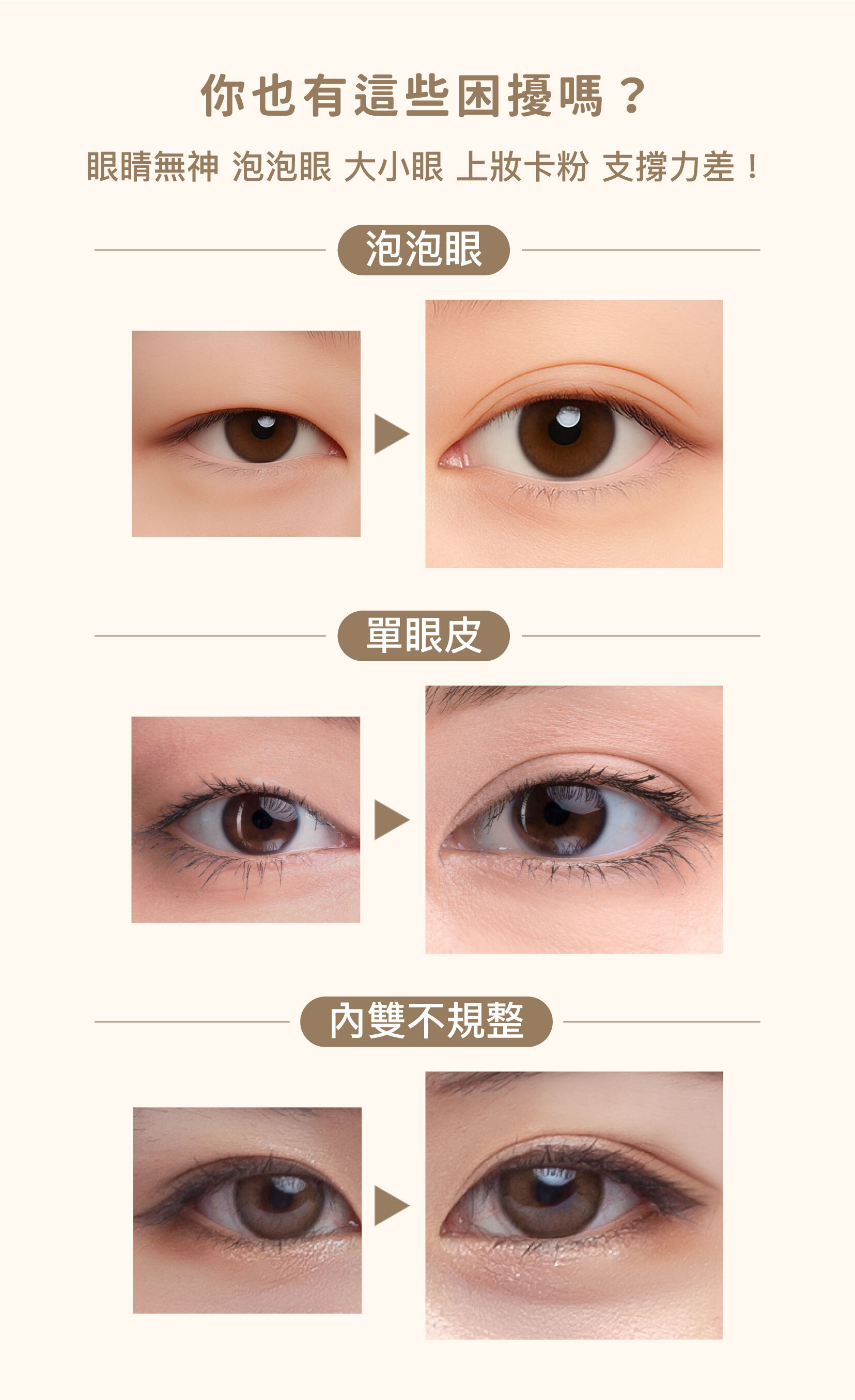 J-LIN 雙眼皮貼大眼系列（三/五/十入組）｜自然放大眼神・3M 輕薄低敏