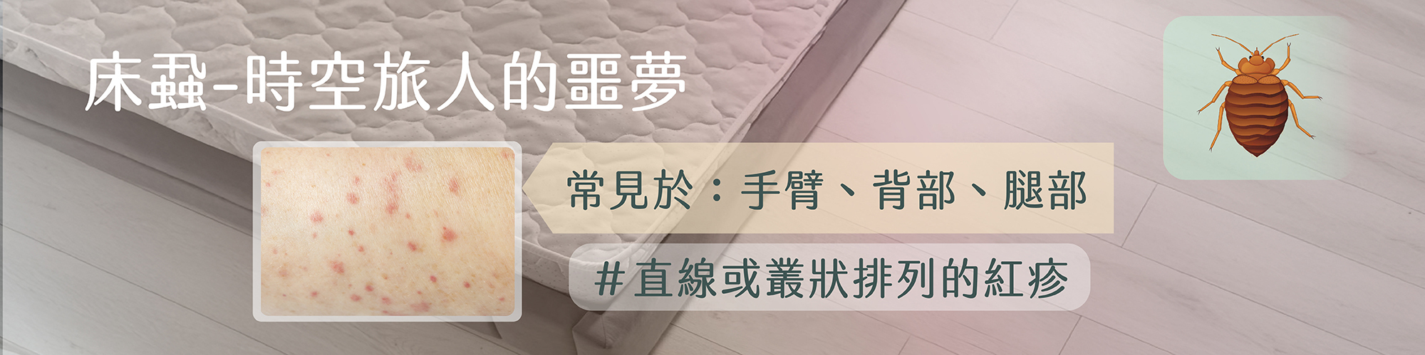 床蝨怎麼處理,旅館床蝨,床蝨叮咬,how to get rid of bed bugs