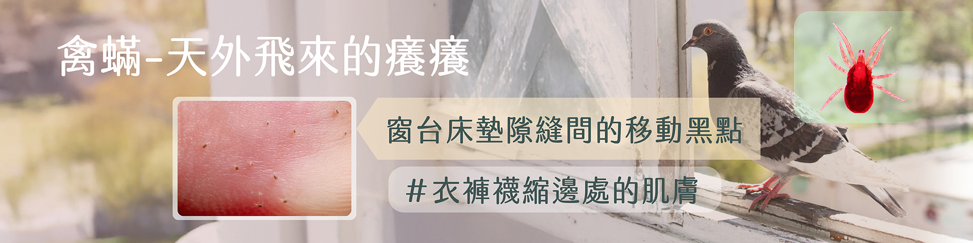 禽蟎咬人,禽蟎過敏,鳥窩附近有跳蚤蟲,tiny bugs biting me at night,bird mites on humans
