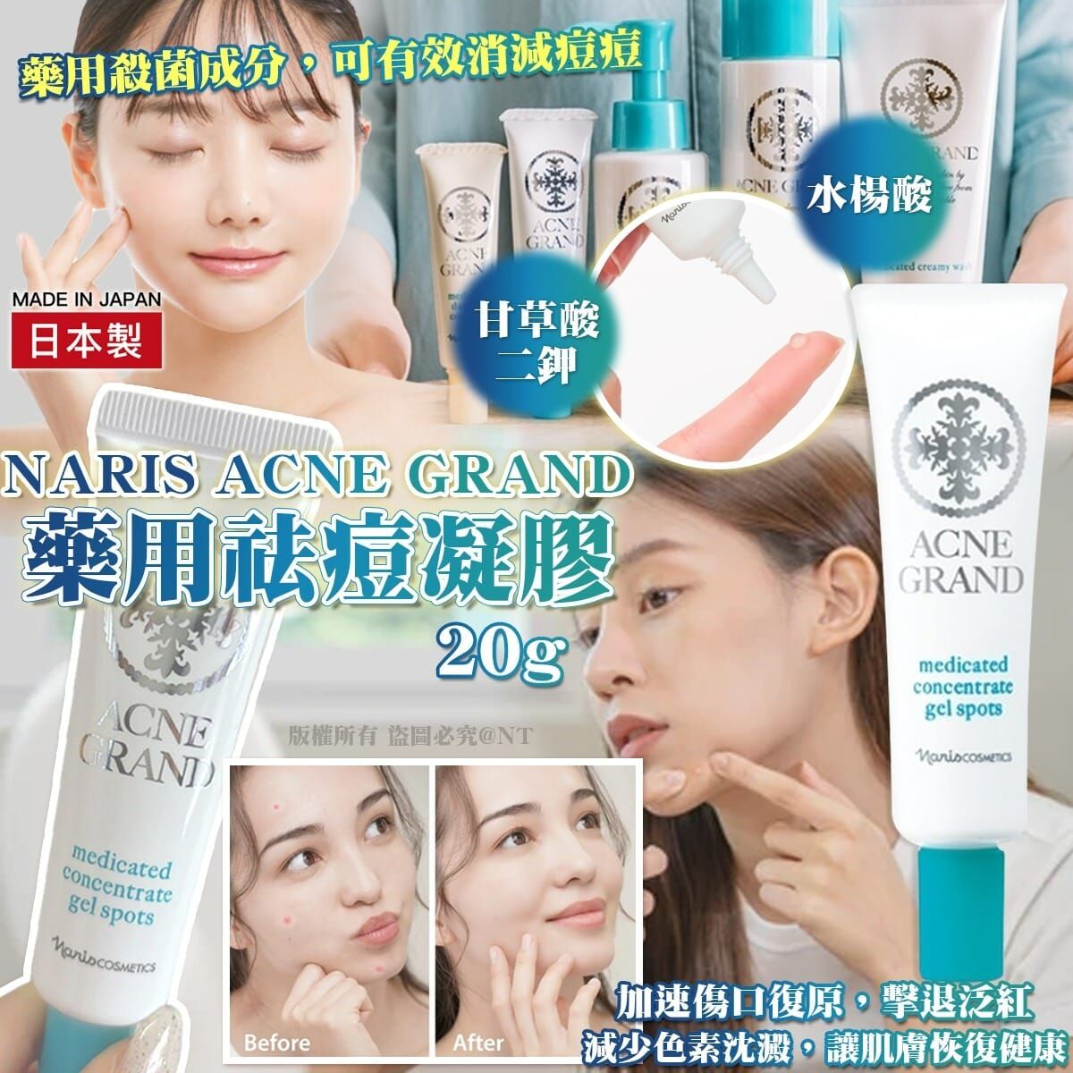 日本製NARIS ACNE GRAND藥用祛痘凝膠20g
