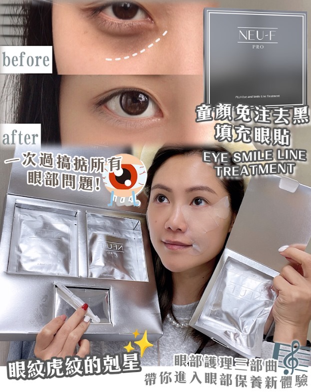 (3613)【送贈品】童顏免注去黑填充眼貼