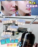 (3619)【買1送1】NEUFACE Pro Recovery Oil 極致修復保濕精華油