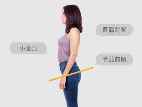 骨盆前傾導致的駝背｜想改善駝背不要忘了骨盆！腰臀核心訓練對抗駝背的最終方法