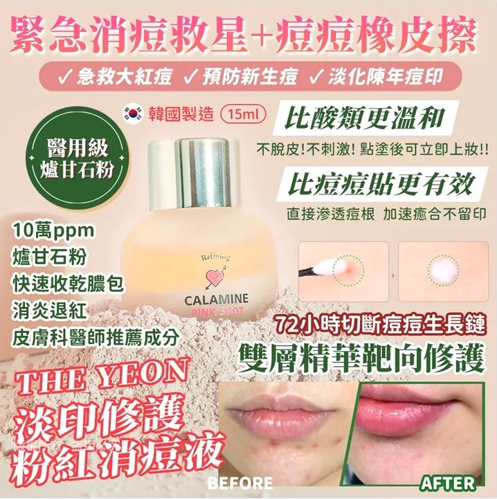 The YEON 韓國 速效去痘粉紅痘痘修復液 15ml