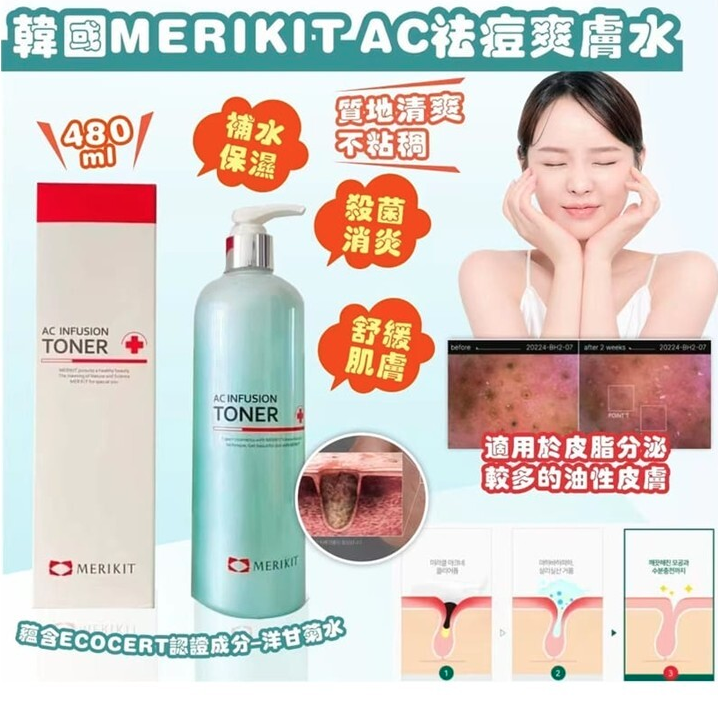 韓國 MERIKIT AC 祛痘爽膚水 480ml