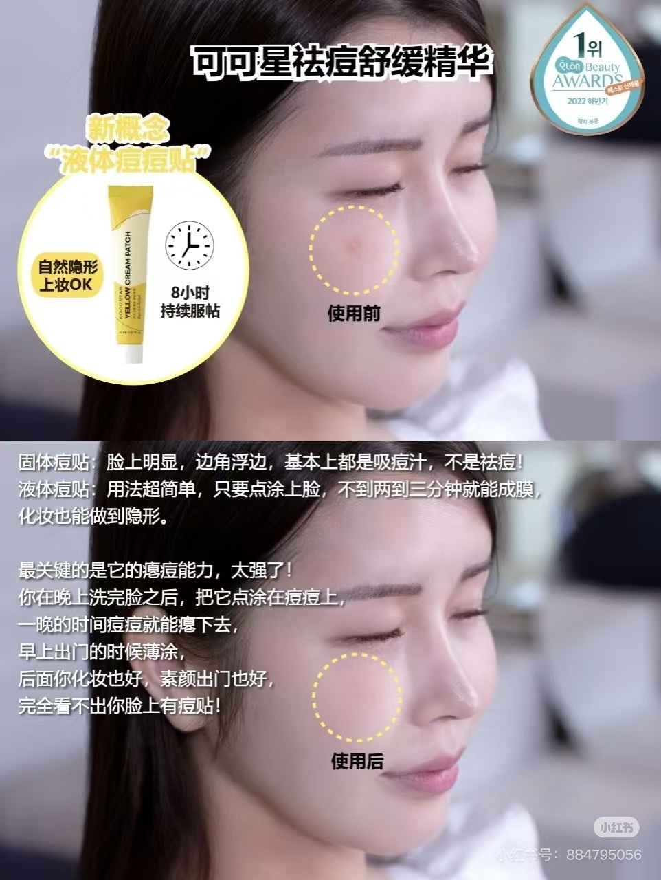 【預購】G0714100 KOCOSTAR 隱形液體痘痘貼 20ml