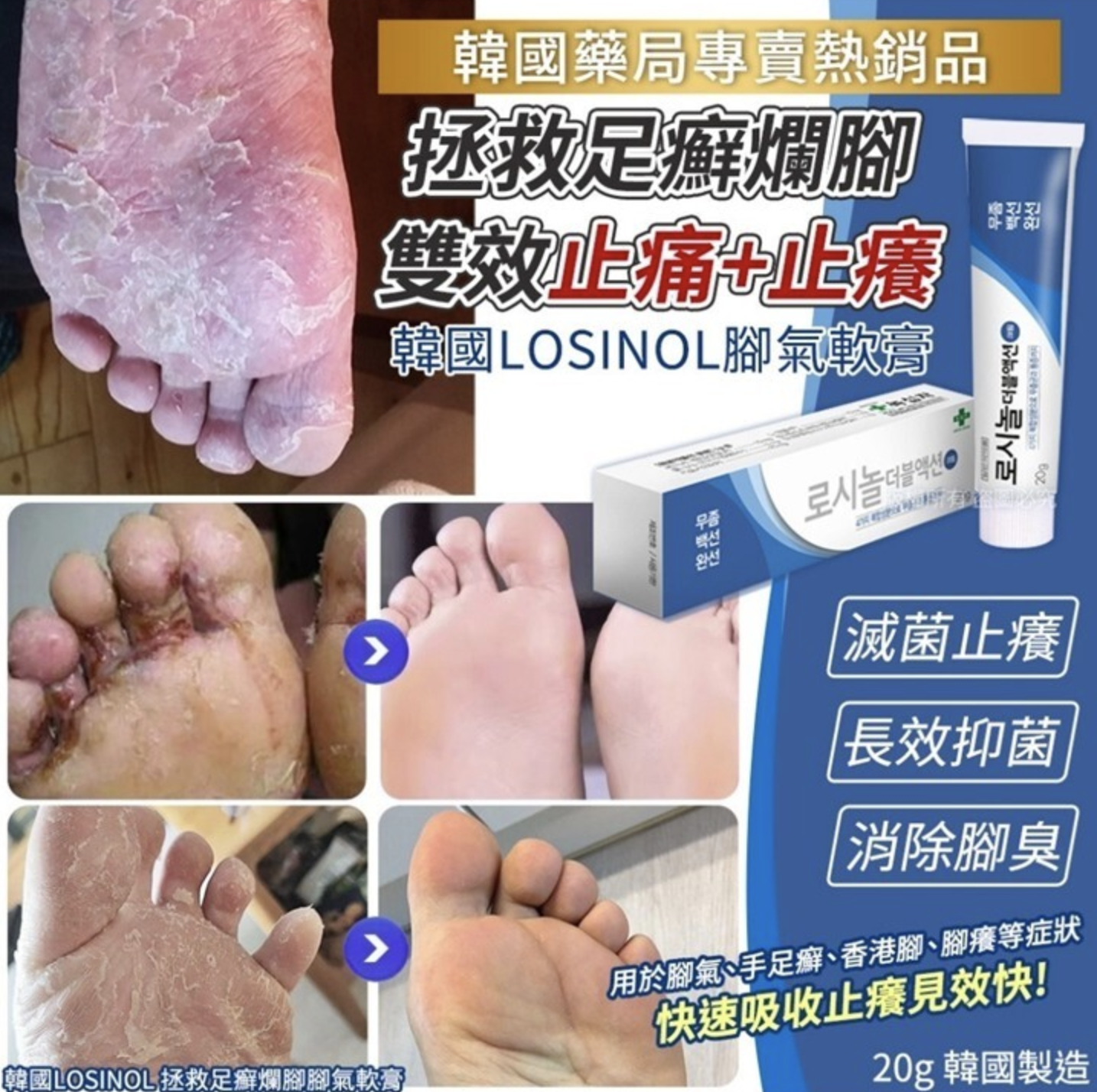 韓國 LOSINOL 拯救足癬爛腳腳氣軟膏 20g