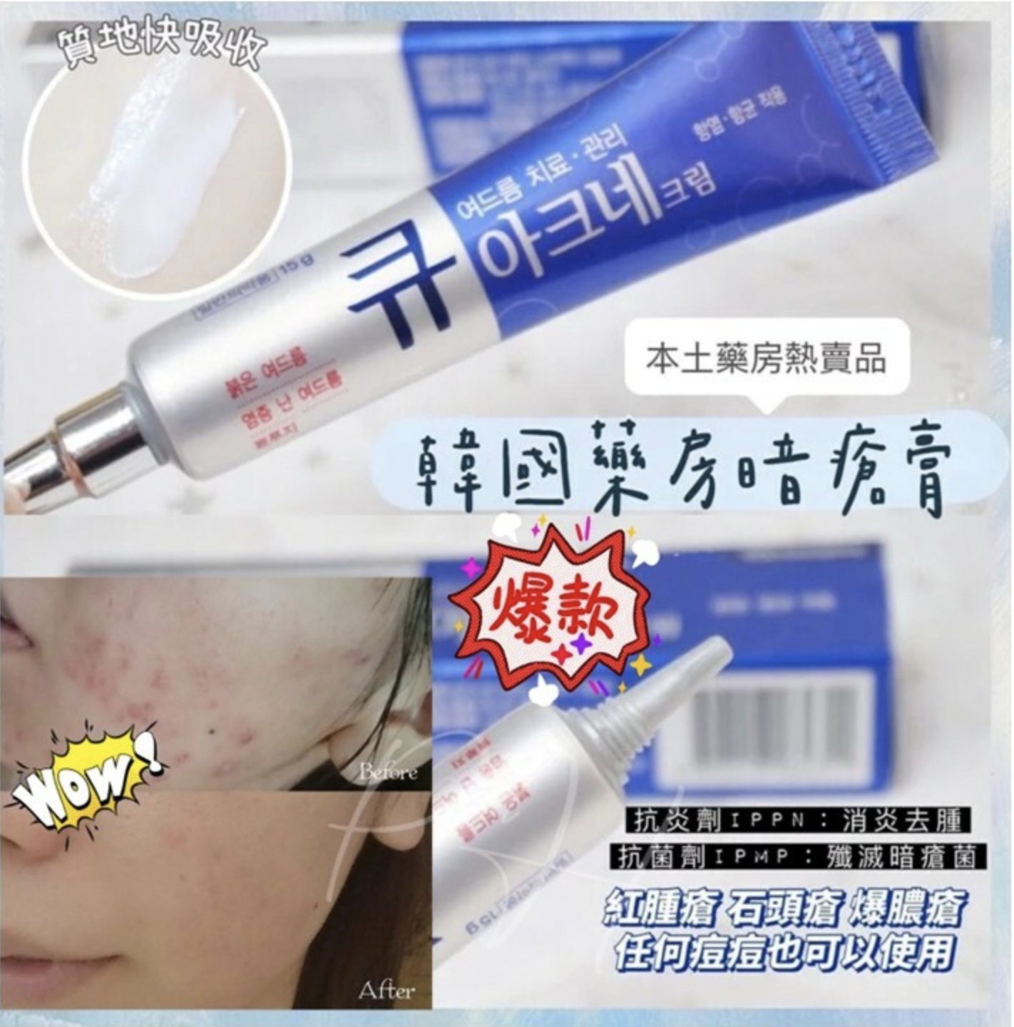 韓國本土藥房熱賣 Q Acne祛痘消炎暗瘡膏15g