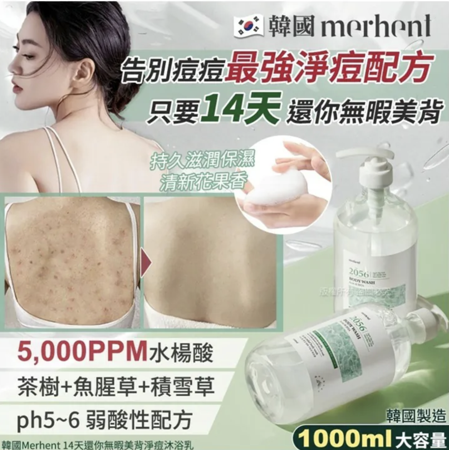 韓國🇰🇷Merhent 14天還你無暇美背淨痘沐浴乳1000ml