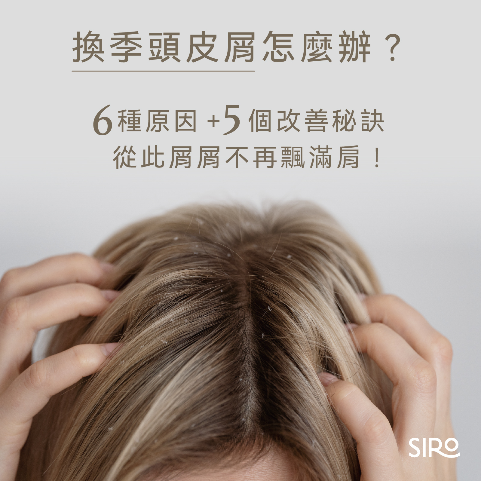 換季頭皮屑怎麼辦？6種原因＋5個改善秘訣，從此屑屑不再飄滿肩！