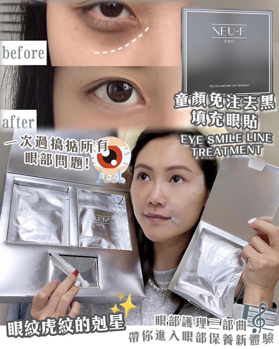 Neu-F Pro PLLA Eye and Smile Line Treatment 童顏免注去黑填充眼貼