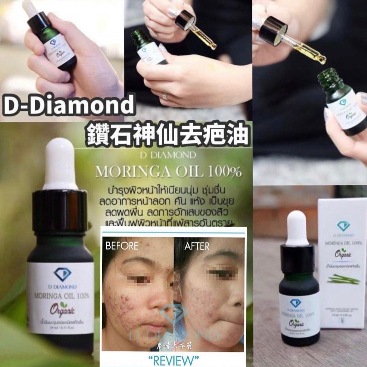 泰國D Diamond鑽石神仙去疤油10ml