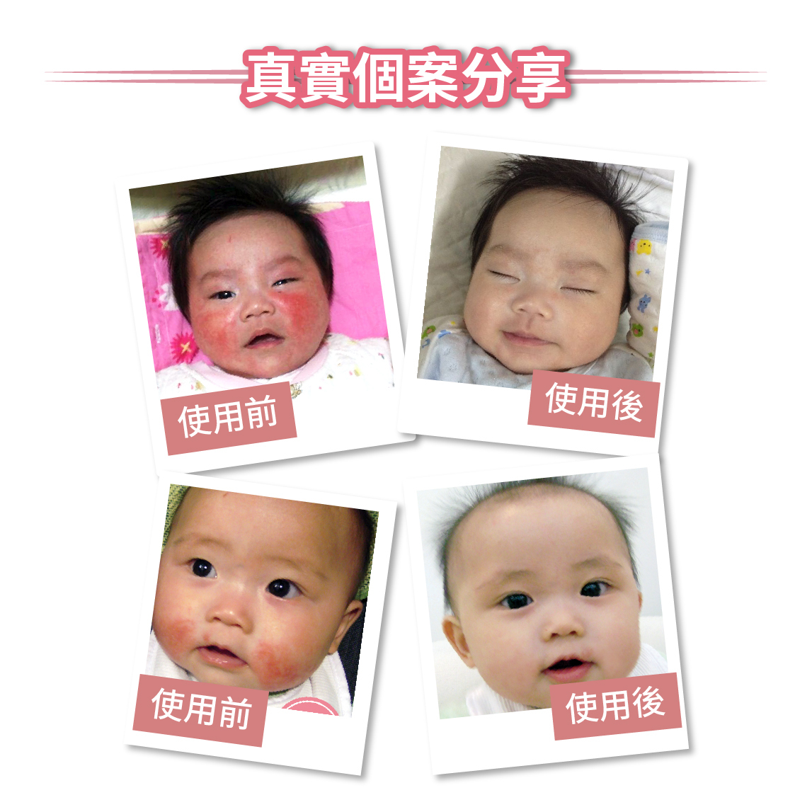 抗敏修護洗髪沐浴露用家分享