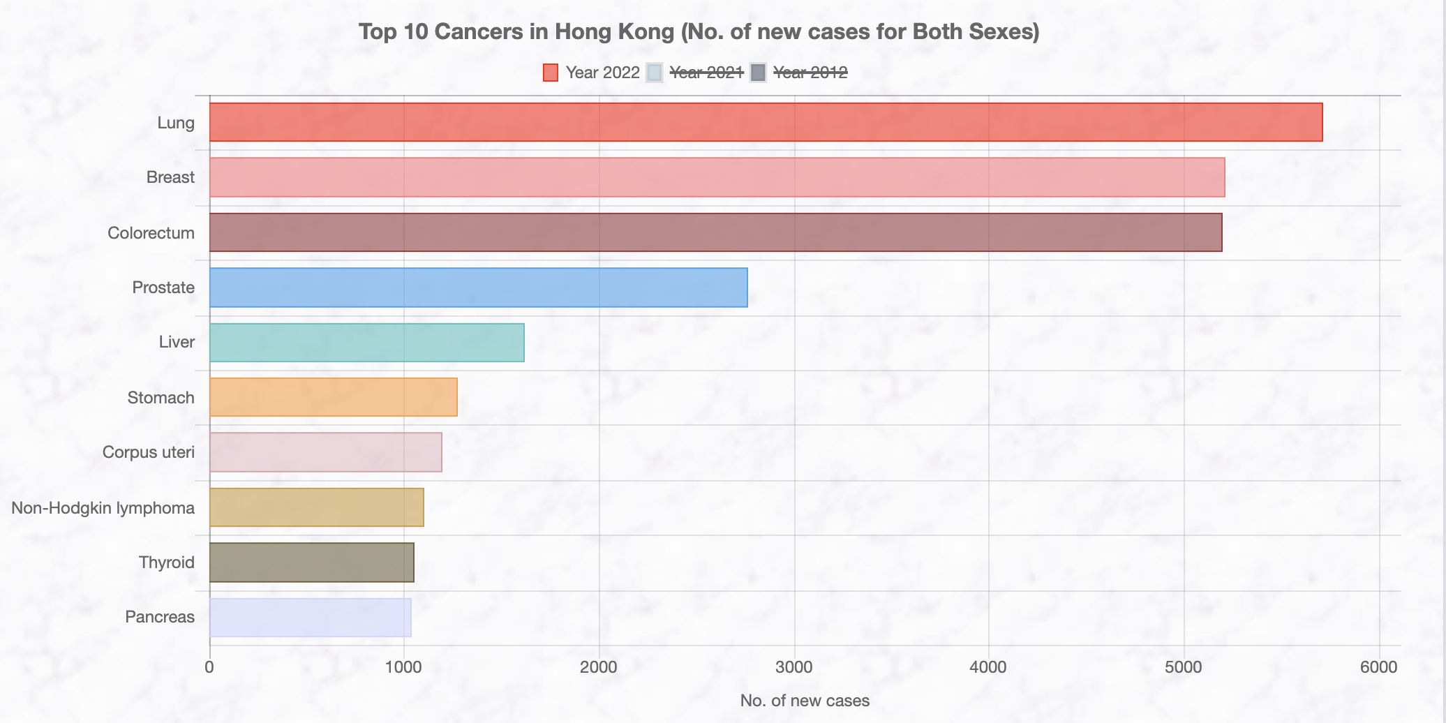 Number of new cases of the top ten cancers in Hong Kong