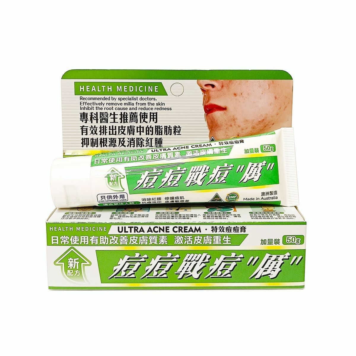 #N/A - Health Medicine - 特效暗瘡膏 50g (平行進口)
