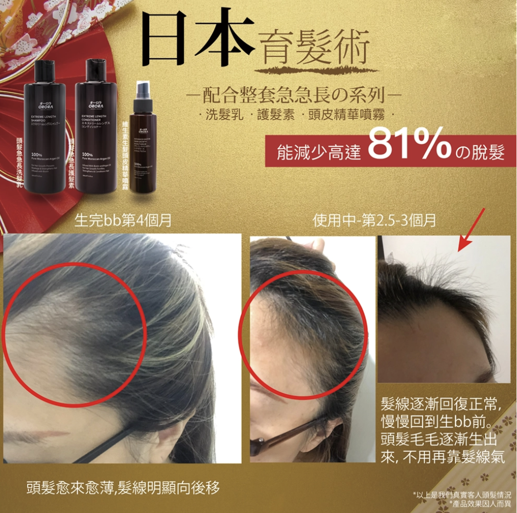 ORORA 日本育髮術維生素防脫髮頭皮精華噴霧 100ml 頭皮精華素