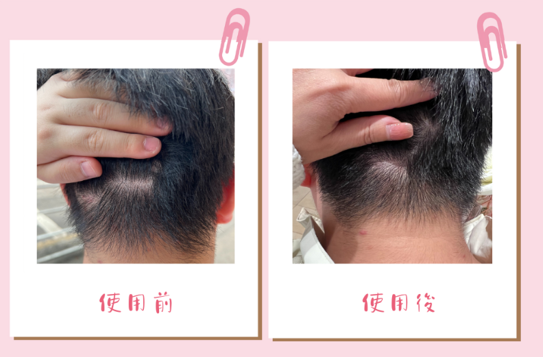 使用前後對比圖