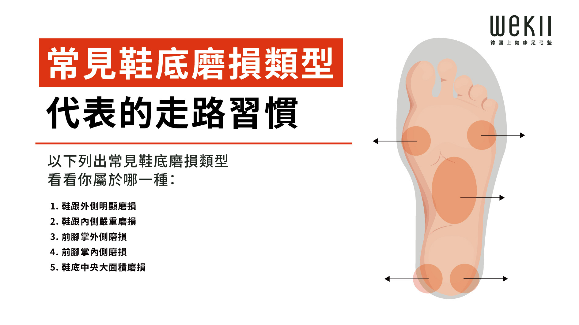 鞋底磨損圖解：從鞋底花紋看出走路方式與足部壓力