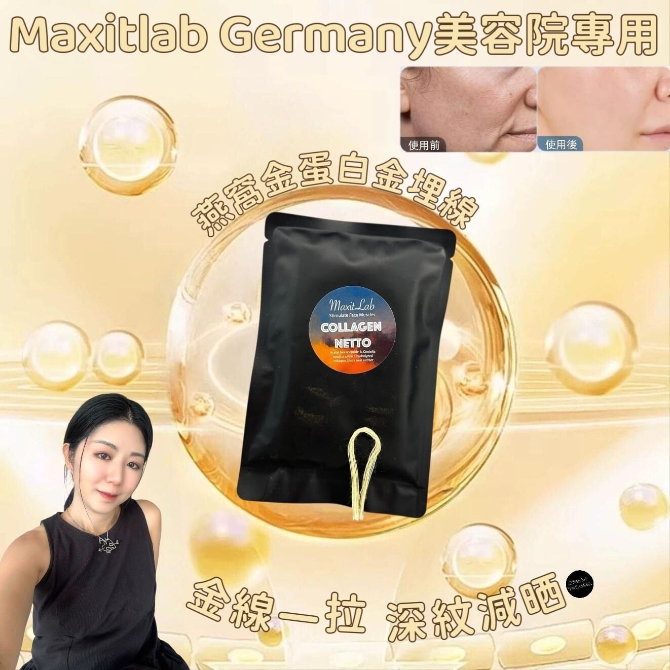 （減淡深皺紋）德國技術Maxitlab Germany 美容院專用燕窩金蛋白金埋線M036 (1 套10包，每包12 條，共120 線)