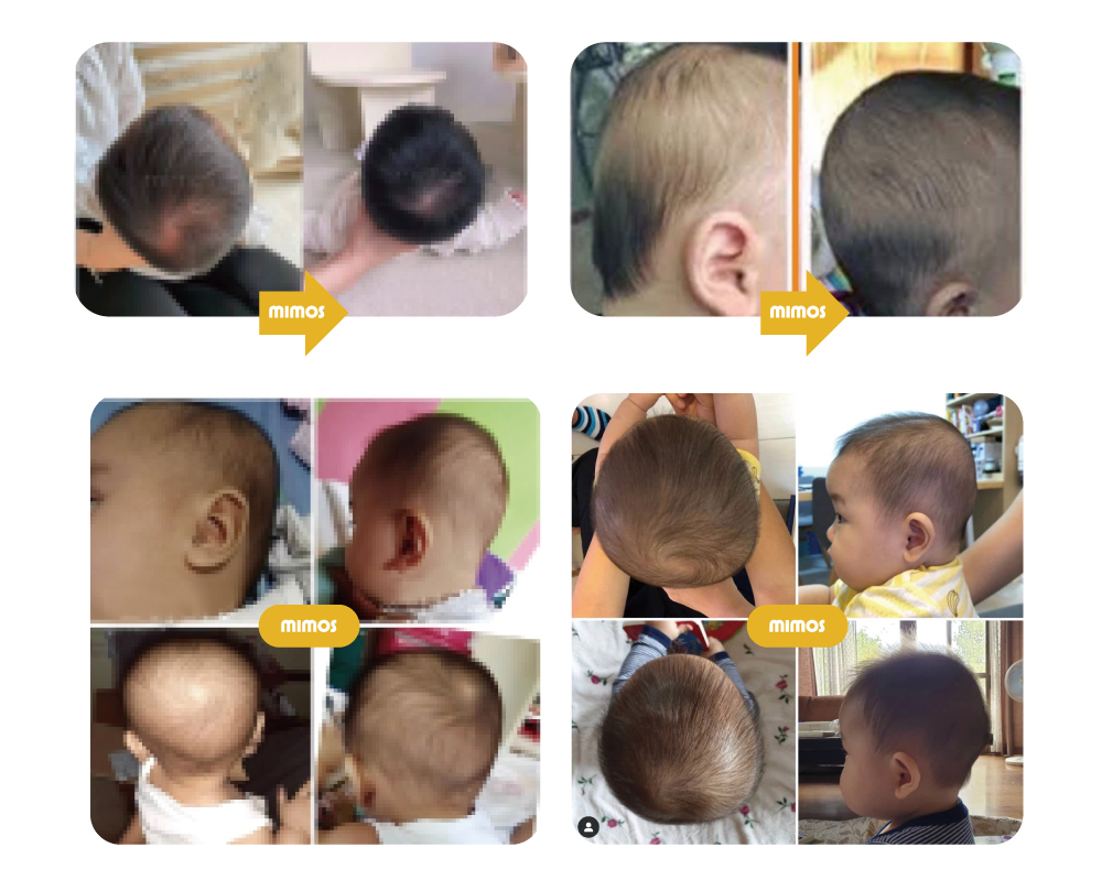 MIMOS嬰兒枕Q&A圖解,說明正確使用方式、如何處理流汗與枕頭濕氣,以及仰睡是最安全的睡姿建議